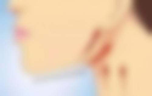 日常注意事项