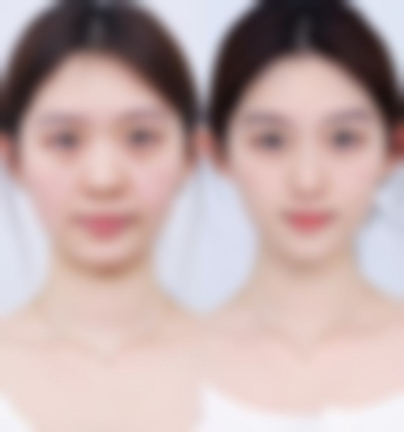 【常熟瑞丽美贝尔整形医院诊疗设备：】