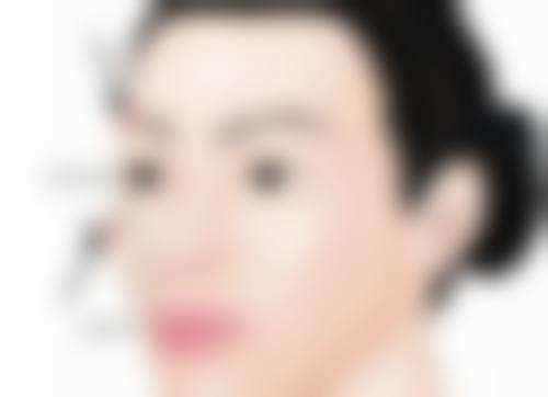 打完瘦脸针注意事项有哪些呢