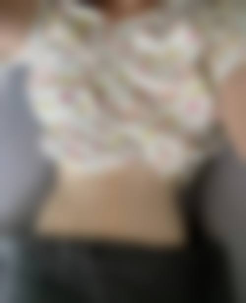 【蒲江美丽部落敏琴医疗美容诊所患者口碑评价：】