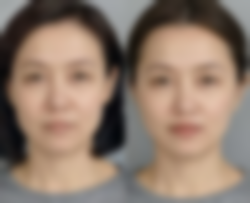 【舟山市微时光医疗美容诊所特色项目：】