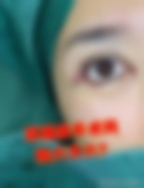 青岛瑧妍美医疗美容医院张为宝适合做哪些医美项目