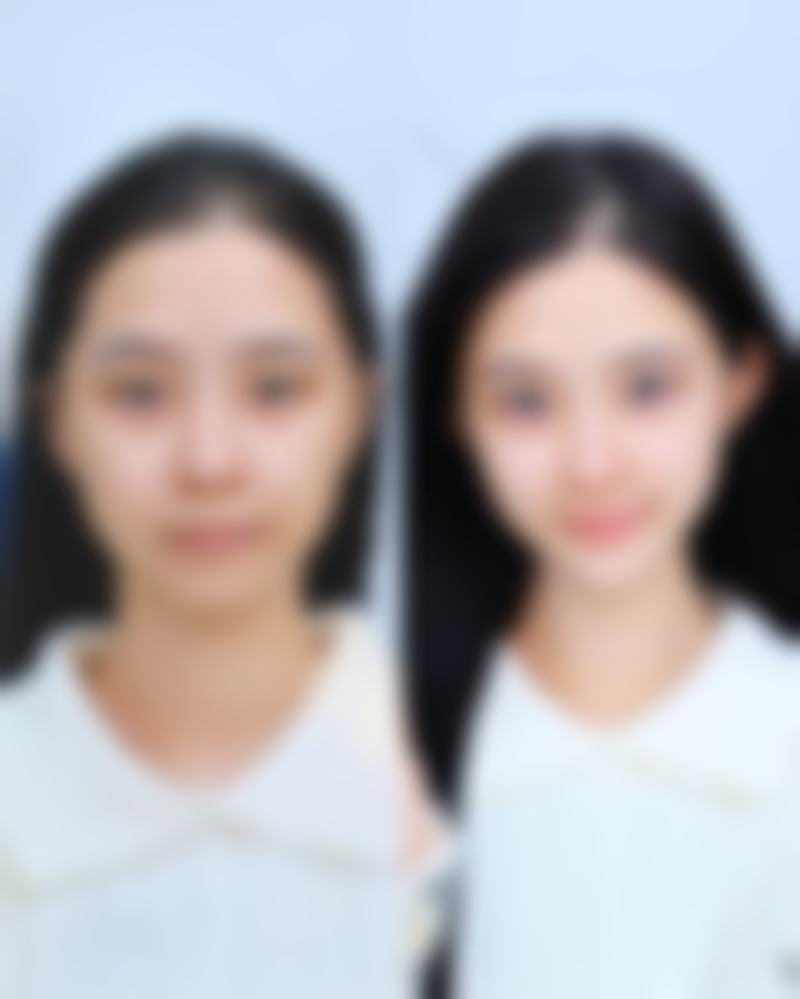 辨别正规整容医院的方法