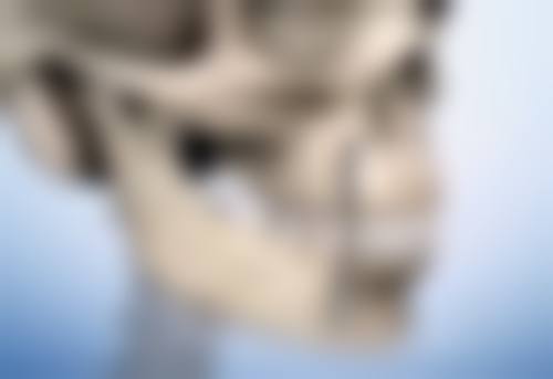 拉皮手术