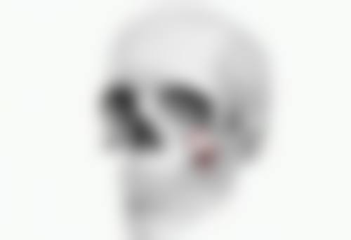 打瘦脸针脸歪了还能修复吗