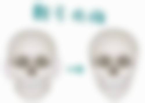 注射除皱的成效怎么样