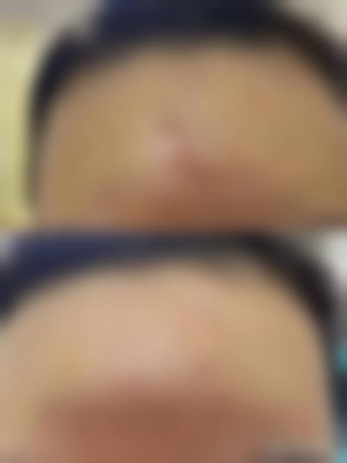 【南京伊美尚整形美容医院特色项目：】