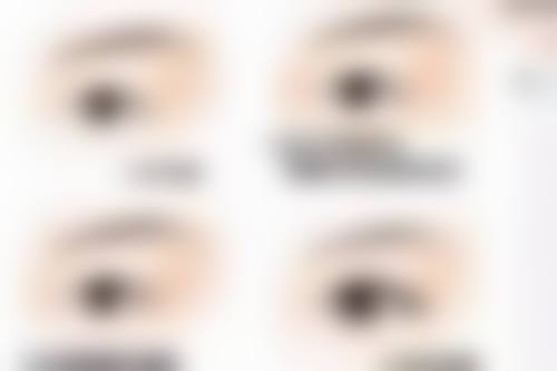打完除皱针多久可以做美容护理