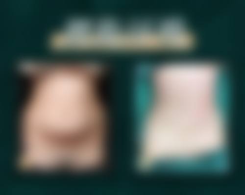广州高尚医学美容中 心余文林手术风格能让顾客满意度再创新高吗？