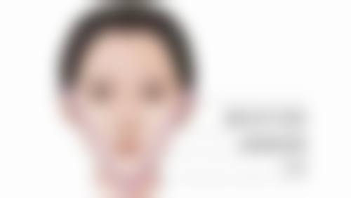 瘦脸针几天开始不扩散