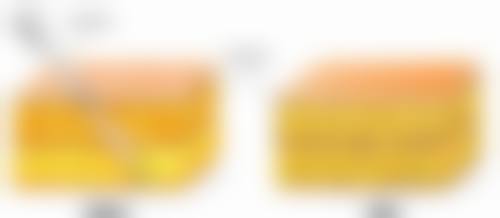 打完瘦脸针脸颊凹陷能修复到以前的样子吗