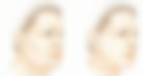 打完瘦脸针多久有成效