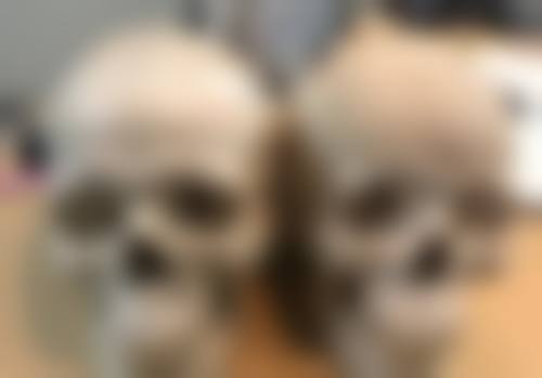 打瘦脸针多少钱一次