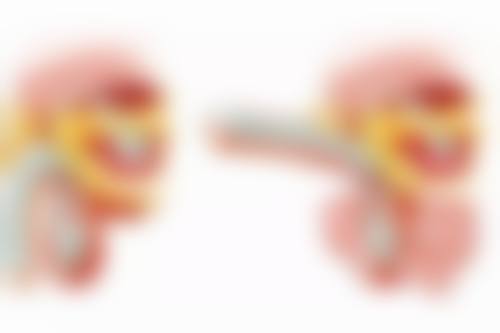 瘦脸针几天后咬肌全部消失