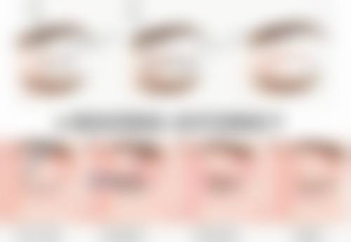打瘦脸针的优点