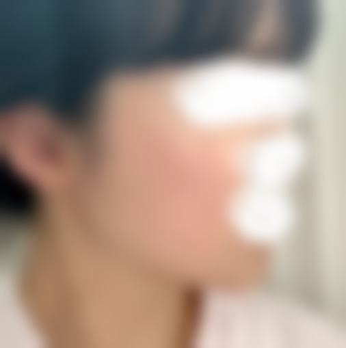 韩国TS整形医院梁淙弼的口碑好不好