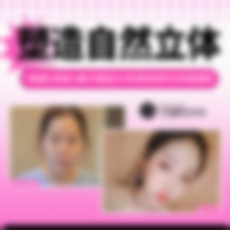 韩国TS整形医院李相均鼻修复手术成效怎么样