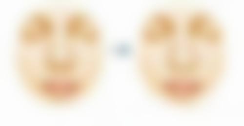 整容可以把脸整白吗