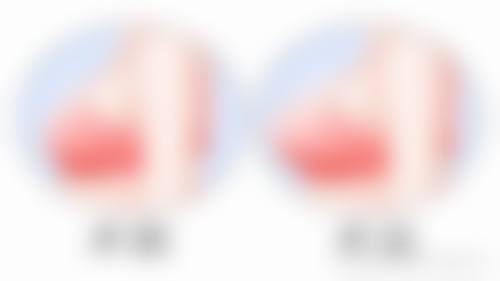 评价二:“之前一直被眼袋问题困扰,尝试了特别多方法都没有成效。来到惠州博瑞懿美整形医院做了无痕祛眼袋手术,没想到成效这么好。现在眼袋没了,眼睛看起来年轻了好几岁。医生和护士都特别专精,整个过程都特别让人放心,以后有美容需求还会来这里。”