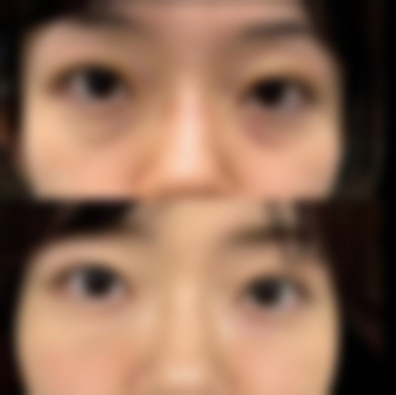 瘦脸针不可以吃什么药材