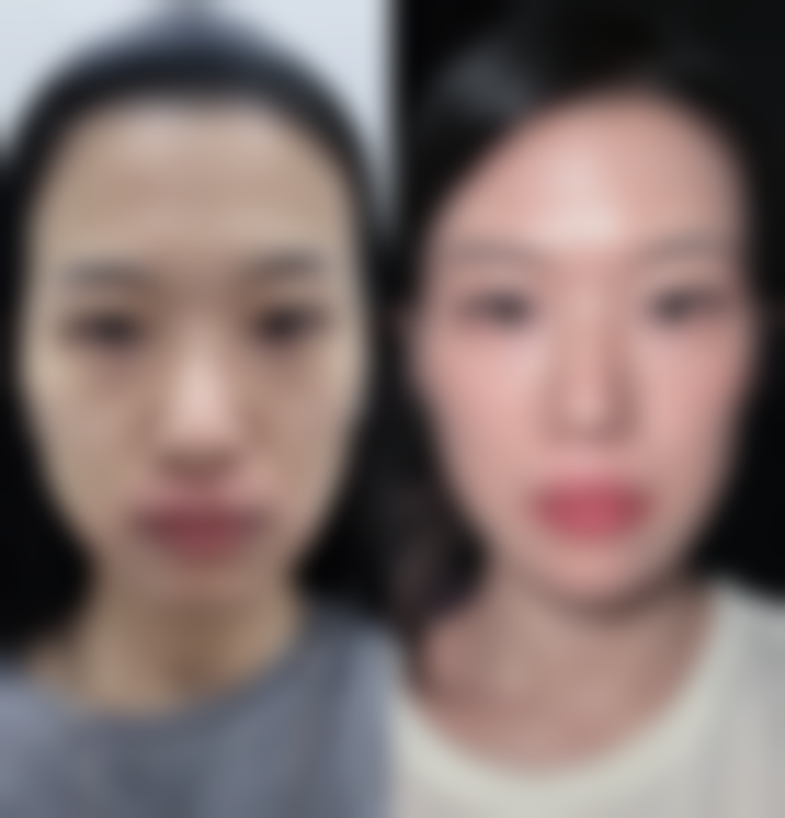 南京江宁小美微甄整形医院特色项目：