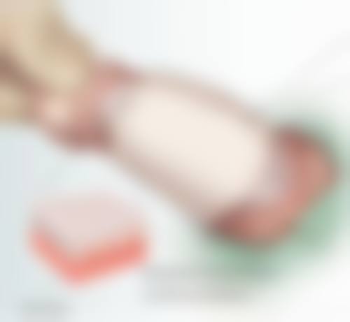 瘦脸针注射后的注意事项
