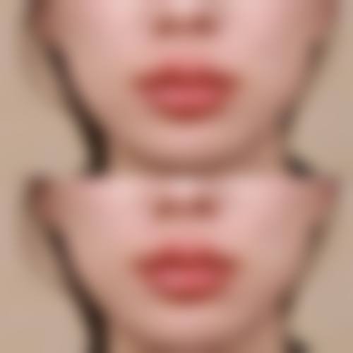 【宿州凯思医疗美容门诊部特色项目:】