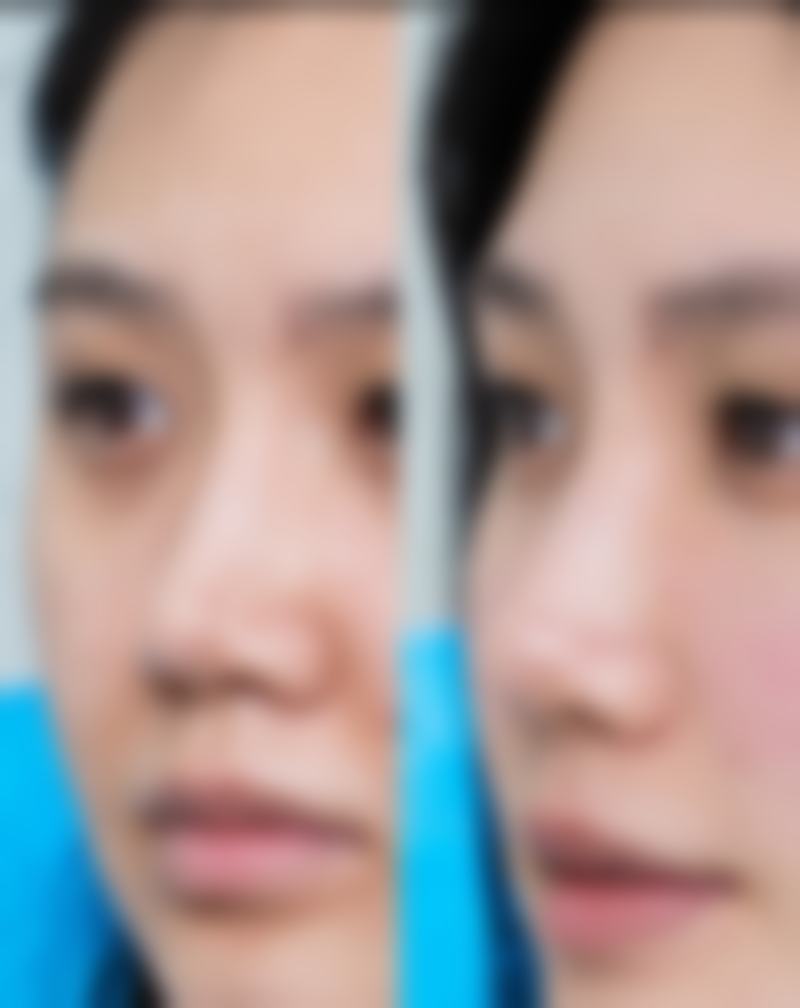 打美白针去哪里更安心