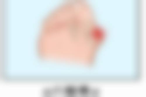 丰太阳穴有成效吗?