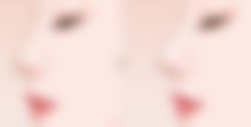 阴道紧缩术的适合人群