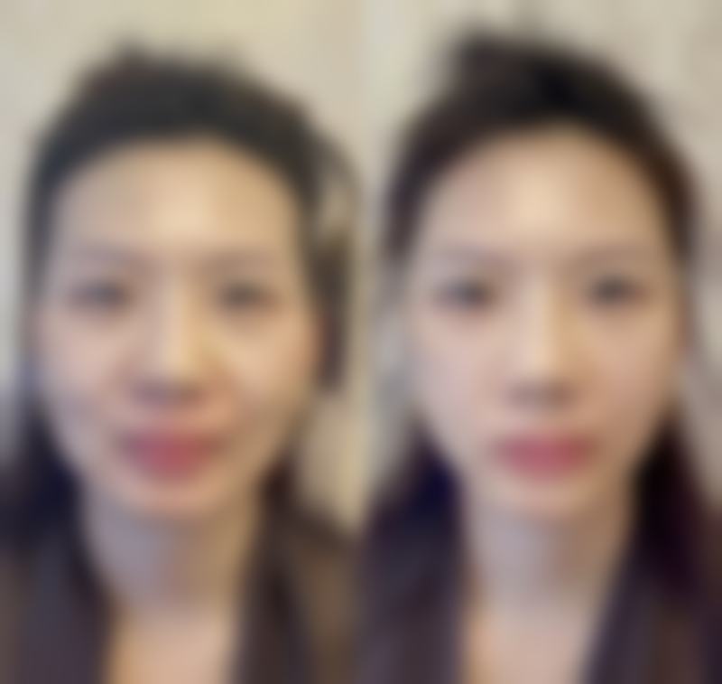【金华市华美整形医院参考价格表：】