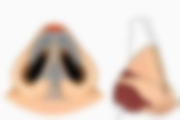 北京蕾士悦容医美第四代热玛吉面颈部 1200 发的预约挂号方式
