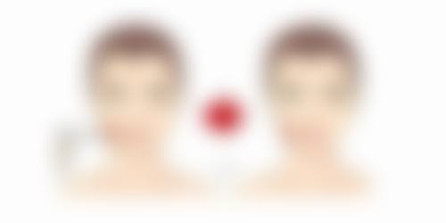 怀孕打了美白针的人有吗？末尾生下的情况如何？