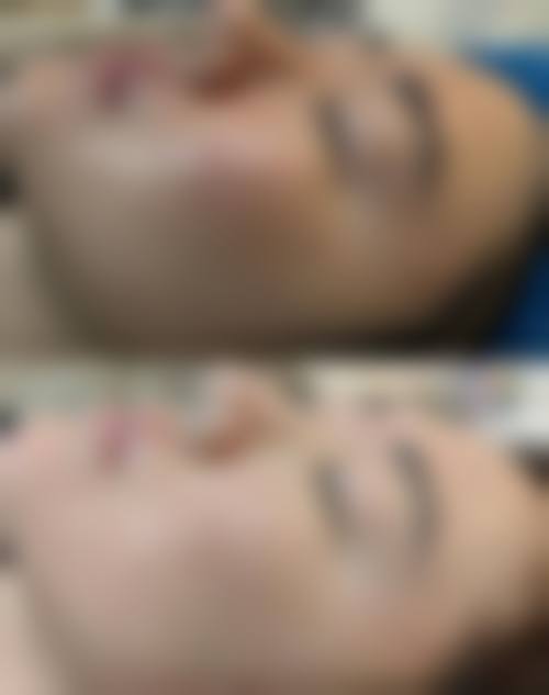【矫玉玲医生技术特点】