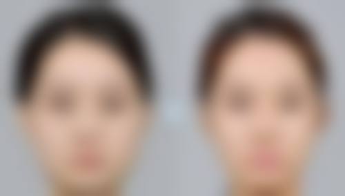 憋尿运动