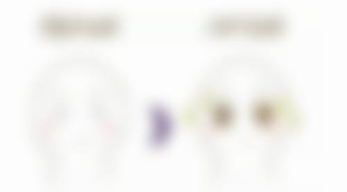 瘦脸针打一针成效明显吗
