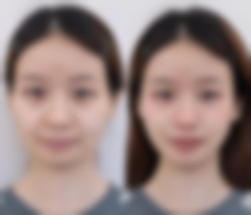 手指能不能做整形