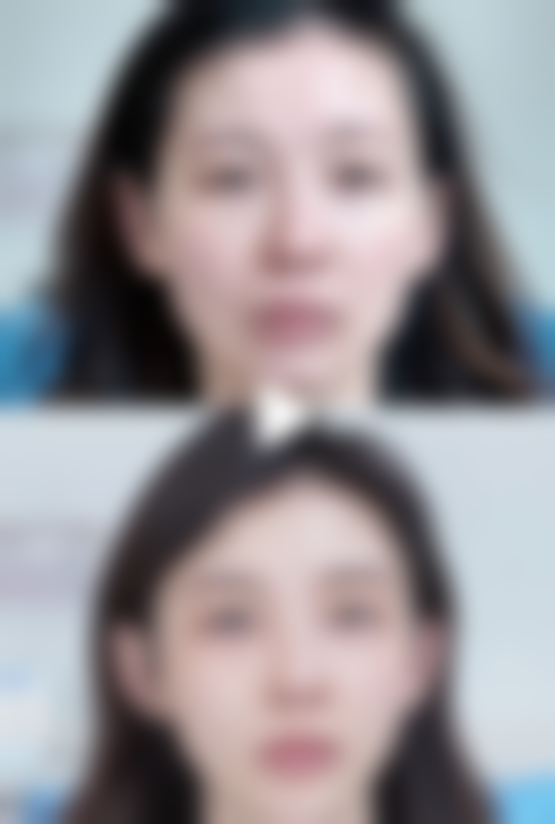 打理想白针的成效