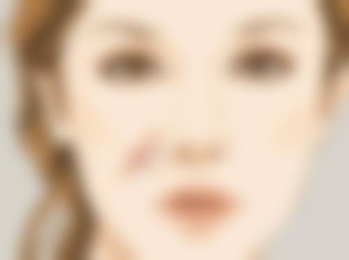 瘦脸治疗后的注意事项