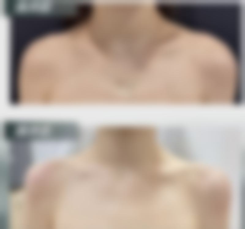 什么脸型减龄