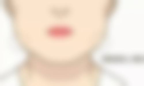 正畸矫正