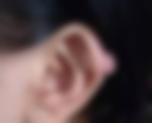 正颌手术