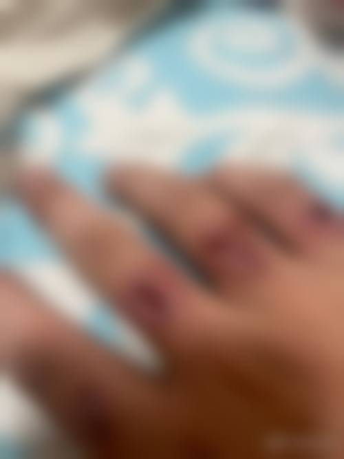 【申娜莉医生擅长项目：】
