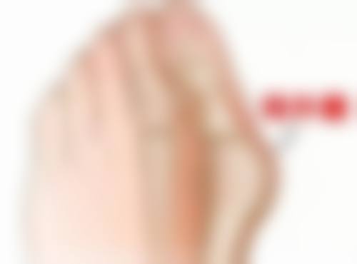 【武汉美成医院特色项目:】