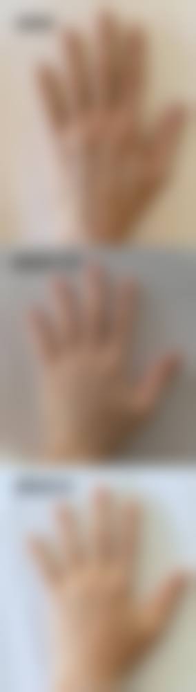 【贺光明医生技术特点】