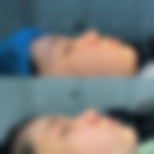 【杜兰余医生擅长项目】