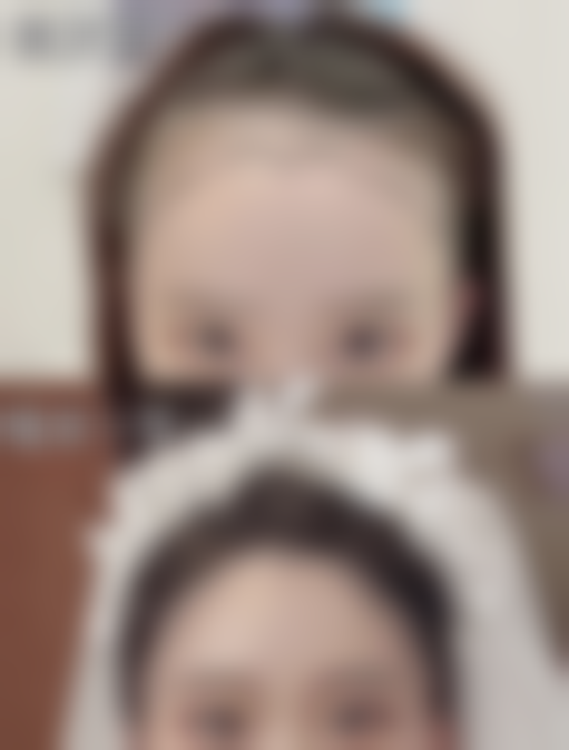 打完瘦脸针多久成效更明显