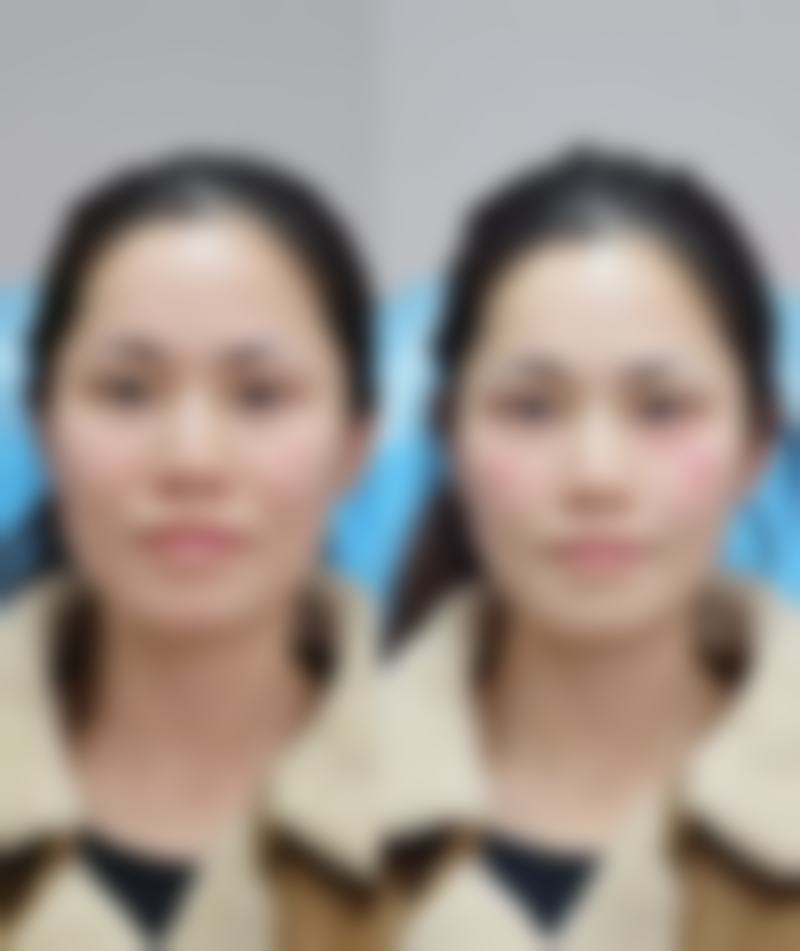 【上海尊然医院皮肤美容科参考价格表:】