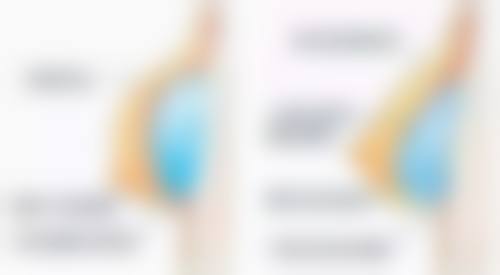 意大利180万美白针真假对比