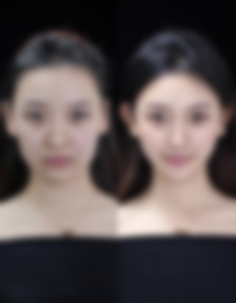 种的毛发会长吗